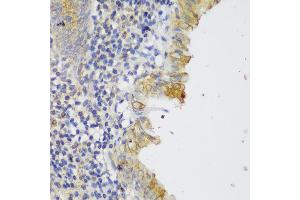 Immunohistochemistry of paraffin-embedded human appendix using GCC2 antibody (ABIN6130422, ABIN6141007, ABIN6141008 and ABIN6217941) at dilution of 1:150 (40x lens). (GCC2 抗体  (AA 1-300))