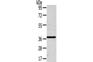 Gel: 8 % SDS-PAGE,Lysate: 40 μg,Primary antibody: ABIN7192440(SLC25A20 Antibody) at dilution 1/200 dilution,Secondary antibody: Goat anti rabbit IgG at 1/8000 dilution,Exposure time: 1 minute (SLC25A2 抗体)