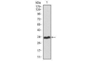 Image no. 1 for anti-Recombination Activating Gene 1 (RAG1) antibody (ABIN1491682) (RAG1 抗体)