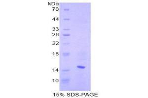 SDS-PAGE (SDS) image for Chemokine (C-C Motif) Ligand 6 (CCL6) (AA 22-116) protein (His tag) (ABIN1880075)