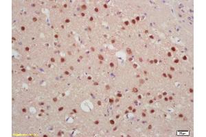 Formalin-fixed and paraffin embedded rat brain labeled with Rabbit Anti Jarid2/Jumonji Polyclonal Antibody, Unconjugated (ABIN1386206) at 1:200 followed by conjugation to the secondary antibody and DAB staining (JARID2 抗体  (AA 301-400))