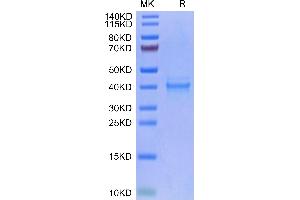 Human IL-12 on Tris-Bis PAGE under reduced condition. (IL12 Protein (His-Avi Tag))