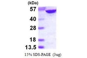 SDS-PAGE (SDS) image for Adenylosuccinate Lyase (ADSL) (AA 1-484) protein (His tag) (ABIN667599) (Adenylosuccinate Lyase Protein (ADSL) (AA 1-484) (His tag))