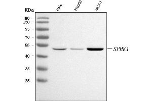 Western blot analysis of SPHK1 using anti-SPHK1 antibody (ABIN7602016).