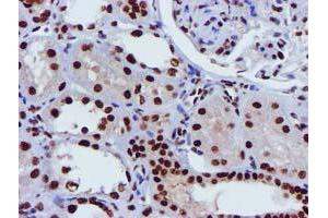 Image no. 3 for anti-Glutathione S-Transferase theta 2 (GSTT2) antibody (ABIN1498553) (GSTT2 抗体)