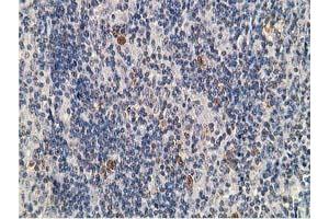 Image no. 4 for anti-Protein Kinase, CAMP-Dependent, Regulatory, Type I, beta (PRKAR1B) antibody (ABIN1500406)