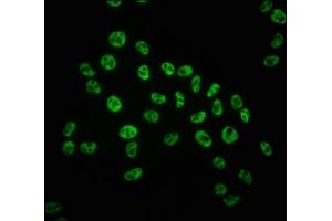 Immunofluorescence staining of Hela cells with ABIN7127726 at 1:100,counter-stained with DAPI. (Recombinant POLR2A/RPB1 抗体  (pSer5))