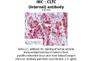 Image no. 1 for anti-Clathrin Heavy Chain (CLTC) (C-Term), (Internal Region) antibody (ABIN1733162) (Clathrin Heavy Chain (CLTC) (C-Term), (Internal Region) 抗体)