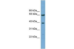 WB Suggested Anti-KLHL20 Antibody Titration: 0. (KLHL20 抗体  (C-Term))