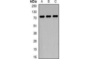 Western blot analysis of TCF4 expression in HepG2 (A), MCF7 (B), mouse brain (C) whole cell lysates. (TCF4 抗体)