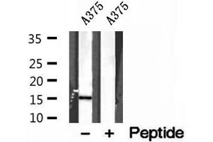 Western blot analysis of extracts of A375 cells, using FABP5 antibody. (FABP5 抗体  (Internal Region))