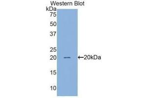 Detection of Recombinant Surv, Human using Monoclonal Antibody to Survivin (Surv) (Survivin 抗体  (AA 1-142))