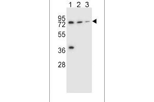 Western blot analysis in NCI-H460(lane 1),HepG2(lane 2),ZR-75-1(lane 3) cell line lysates (35ug/lane).