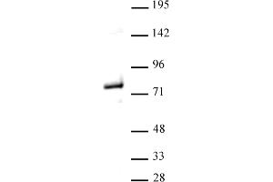 Western blot of Menin antibody. (Menin 抗体  (C-Term))