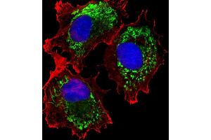 Fluorescent image of MCF-7 cells stained with ALDH6A1 Antibody (ABIN659006 and ABIN2838041). (ALDH6A1 抗体)