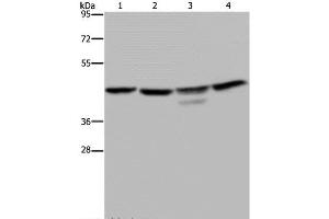 Western Blot analysis of K562 and 293T cell, Jurkat cell and Mouse brain tissue using CSNK2A1 Polyclonal Antibody at dilution of 1:300 (CSNK2A1/CK II alpha 抗体)