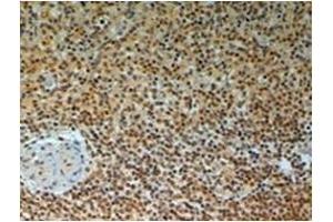 Immunohistochemistry (Paraffin-embedded Sections) (IHC (p)) image for anti-TRAF Interacting Protein (TRAIP) (C-Term) antibody (ABIN783910) (TRAIP 抗体  (C-Term))