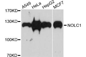Western blot analysis of extracts of various cell lines, using NOLC1 antibody. (NOLC1 抗体)