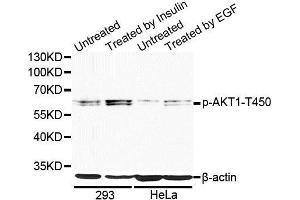 Western blot analysis of extracts of 293 and HeLa cells, using Phospho-AKT1-T450 antibody (ABIN5969867) at 1/1000 dilution. (AKT1 抗体  (pThr450))