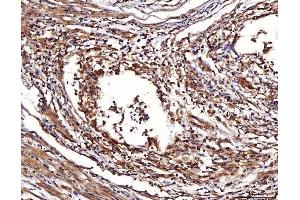 IHC analysis of ENO1 using anti-ENO1 antibody (ABIN7601902).
