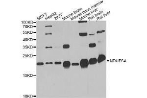 Western blot analysis of extracts of various cell lines, using NDUFS4 antibody. (NDUFS4 抗体)