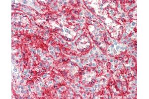 Immunohistochemistry (IHC) image for anti-Major Histocompatibility Complex, Class I, A (HLA-A) (AA 70-99) antibody (ABIN1902365)