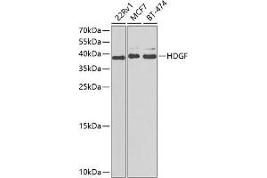 Western blot analysis of extracts of various cell lines, using HDGF antibody  at 1:1000 dilution. (HDGF 抗体  (AA 1-240))