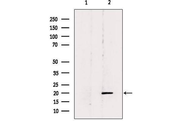 Betacellulin 抗体  (N-Term)