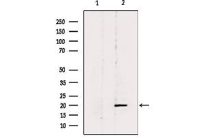 Western blot analysis of extracts from 293, using BTC Antibody. (Betacellulin 抗体  (N-Term))