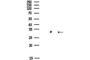 Western blot analysis of lysates from HUVEC cells(starvation,24h treatment), using SLC25 Antibody at 1/1000 dilution.