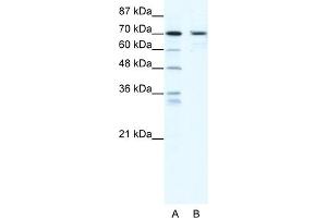 WB Suggested Anti-PRDM1 Antibody Titration:  2. (PRDM1 抗体  (N-Term))
