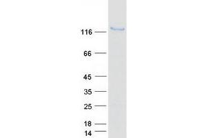 Western Blotting (WB) image for Calpastatin (CAST) (Transcript Variant 1) protein (Myc-DYKDDDDK Tag) (ABIN2713066)