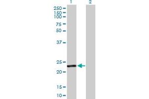 Western Blot analysis of GSTA4 expression in transfected 293T cell line by GSTA4 MaxPab polyclonal antibody. (GSTA4 抗体  (AA 1-222))