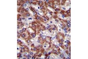 Immunohistochemistry analysis in formalin fixed and paraffin embedded human liver tissue reacted with OR2B11 Antibody (C-term) followed which was peroxidase conjugated to the secondary antibody and followed by DAB staining. (OR2B11 抗体  (C-Term))