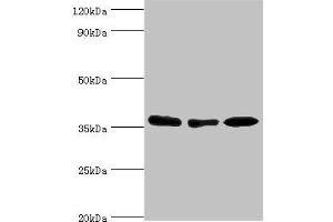 Western blot All lanes: MDH1 antibody at 4 μg/mL Lane 1: HepG2 whole cell lysate Lane 2: Hela whole cell lysate Lane 3: Mouse kidney tissue Secondary Goat polyclonal to rabbit IgG at 1/10000 dilution Predicted band size: 37, 28, 39 kDa Observed band size: 37 kDa (MDH1 抗体  (AA 1-334))