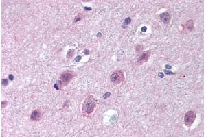 Human Brain, Cortex (formalin-fixed, paraffin-embedded) stained with IPO9 antibody ABIN297232 at 10 ug/ml followed by biotinylated goat anti-rabbit IgG secondary antibody ABIN481713, alkaline phosphatase-streptavidin and chromogen. (Importin 9 抗体  (AA 950-1000))