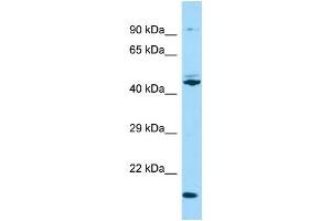 Western Blotting (WB) image for anti-Outer Dense Fiber of Sperm Tails 3 (ODF3) (N-Term) antibody (ABIN2790487) (ODF3 抗体  (N-Term))