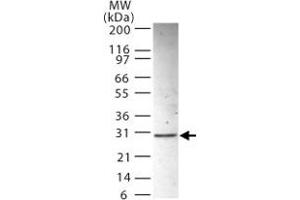 Western blot analysis of ANP32B in HL-60 whole cell lysate using ANP32B polyclonal antibody  at 2 ug/mL . (ANP32B 抗体  (AA 1-17))