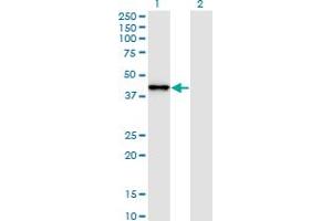 Western Blot analysis of SNAPC2 expression in transfected 293T cell line by SNAPC2 monoclonal antibody (M01), clone 4B8. (SNAPC2 抗体  (AA 16-114))