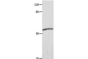 Western Blot analysis of Human fetal muscle tissue using CAP2 Polyclonal Antibody at dilution of 1:600 (CAP2 抗体)