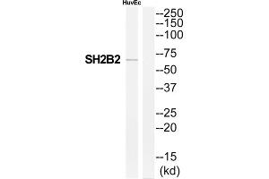 Western Blotting (WB) image for anti-SH2B Adaptor Protein 2 (SH2B2) (Internal Region) antibody (ABIN1852148) (SH2B2 抗体  (Internal Region))