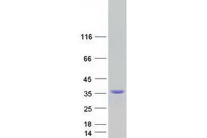 C1QL2 Protein (Myc-DYKDDDDK Tag)