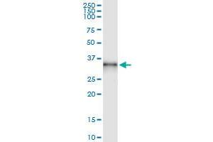 Immunoprecipitation of CBR3 transfected lysate using anti-CBR3 MaxPab rabbit polyclonal antibody and Protein A Magnetic Bead , and immunoblotted with CBR3 purified MaxPab mouse polyclonal antibody (B01P) . (CBR3 抗体  (AA 1-277))