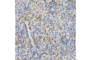 Immunohistochemistry of paraffin-embedded rat spleen using IL11RA Rabbit mAb (ABIN7267984) at dilution of 1:150 (40x lens). (IL11RA 抗体)