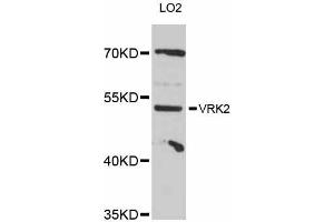 Western blot analysis of extracts of LO2 cells, using VRK2 antibody (ABIN5999182) at 1:3000 dilution. (VRK2 抗体)