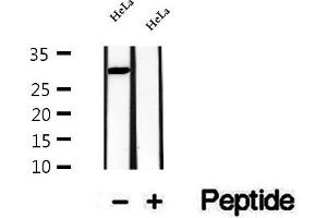 Western blot analysis of extracts of HeLa cells, using CPSF4 antibody. (CPSF4 抗体  (C-Term))
