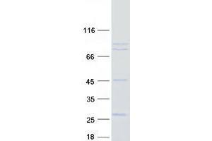 Western Blotting (WB) image for Ubiquitin Specific Peptidase 44 (USP44) (Transcript Variant 2) protein (Myc-DYKDDDDK Tag) (ABIN2735126)