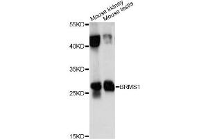 Western blot analysis of extracts of various cell lines, using BRMS1 antibody (ABIN6290118) at 1:1000 dilution. (BRMS1 抗体)