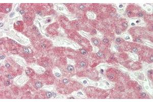 Detection of IFNb in Human Liver Tissue using Polyclonal Antibody to Interferon Beta (IFNb) (IFNB1 抗体  (AA 22-187))