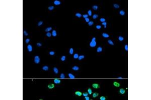 Immunofluorescence analysis of HeLa cells using IRF5 Polyclonal Antibody (IRF5 抗体)